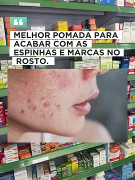 Melhor pomada para acabar com as espinhas e marcas no rosto.  #medicamentos #farmacia #saude #bemestar #drogaria #espinhas #acne #rosto #marcasdeacne #dermatologia 