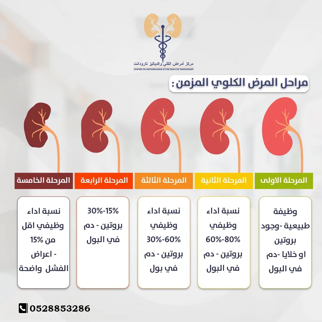 مراحل المرض الكلوي المزمن: 0528853286 النجاح رقم 1 لاسطاح - تارودانت - المغرب ‏#kidneyhealth #healthydietforkidneys ‏#kidneyproblems #kidneyfoods #kidneyhealth ‏#kidneyscreening #kidney ‏#kidneycareandhomehealthcare #homecare ‏#healthcare #clinic #علاج_الكلى #الفشل_الكلوي #المغرب #صحة #صحة_#الكلى #الدياليز #امراض_الكلى