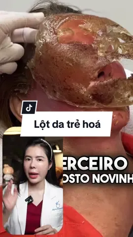 Vì sao hiệu quả nhưng VN không dùng? #depcungdrnhung #chamsocda #trinam #trehoa 