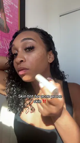I recently found out i was allergic to my foundation 🥲 im ONLY using this skin tint from now on!!! 