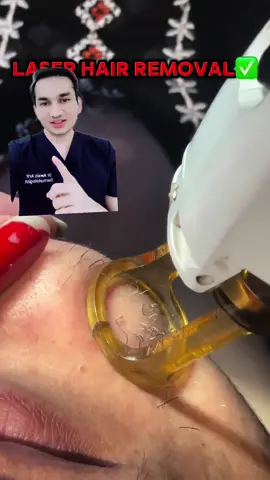 Is this the best way to do laser hair removal? Watch this video for educational insights! #drawaisarif #skincare #trending #foryou #fyp 
