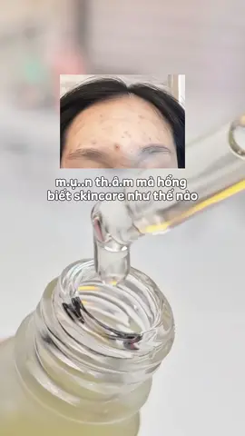 Serum dành cho da t.hâ.m m.ụ.n nè  #serumviral  #thammun  #banacocoreview  #tipskincare  #heyme  #dadaumun 