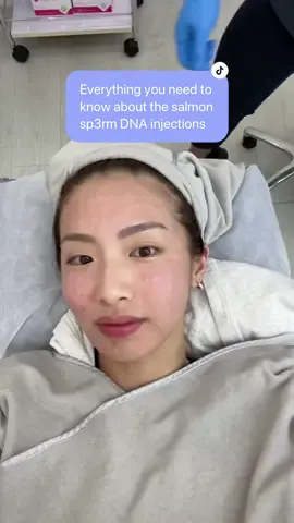 Everything to know about the salmon DNA facial 🐟 cost, pain, recovery and more! I got my treatment at📍@Cheongdam 청담 Aesthetics Clinic in Singapore  #rejuran #salmondnatreatment #salmondna #koreanskincare 