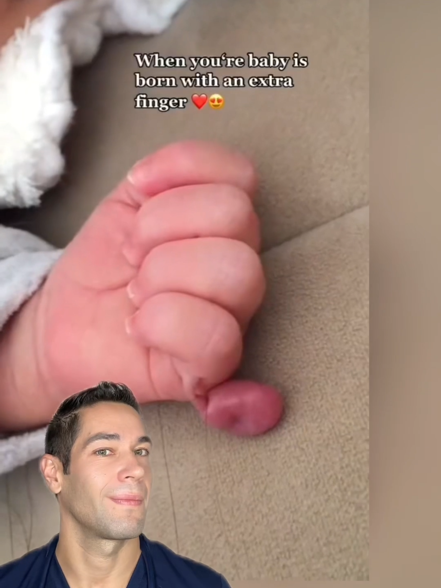 Don't be alarmed! #newborn #medical #doctorexplains #birth