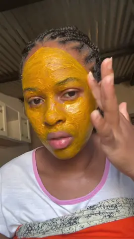 This face mask will: - sooth inflamated skin - reduce blemishes - fight acne - reduce dark spots and brighten skin #turmeric #turmericmask #turmericskincare #acne #homeremedy #naturalbasedhaircare #skincare #eventoneskin 