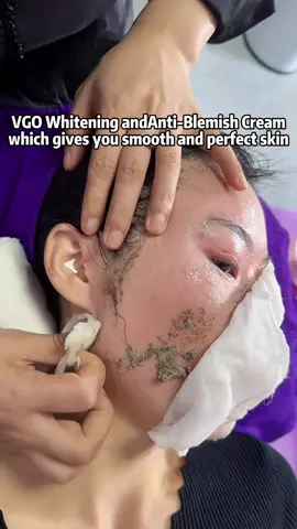 Recoment bangt buat wajah kalian yang kusam & banyak flek hitam nya!#glowingskin #skinwhitening #pigmentation #beauty #darkspots #antiaging #wrinkles #homemade #skincare #freckles#VGO 