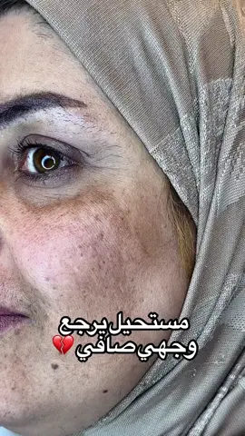 ##كريمات_تفتيح_البشرة_والجسم_خلطات #الشعب_الصيني_ماله_حل😂😂 #المملكة_العربية_السعودية #المملكة_العربية_السعودية #اكسبلور #اليوم_الوطني_السعودي_93 #الشعب_الصيني_ماله_حل #تصبغات #تبييض #الامارات_العربية_المتحده🇦🇪 #خلطات_شوق #تصبغات_الوجه #الشعب_الصيني_ماله_حل😂✌️ #المملكة_العربية_السعودية🇸🇦 