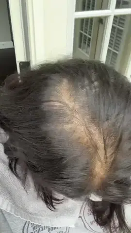 👍 Visible results after just a few weeks. #pomelohairtonic #cocoonoriginalus #cocoonoriginal