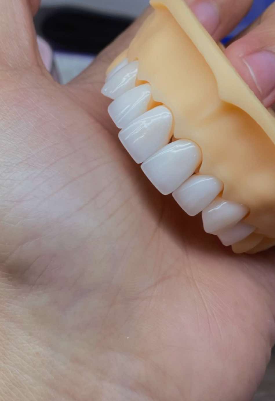 Thử form vuông mà khó quá  🦷🦷 #zirconia #labomq #rangsuthammy #dental #foryou #răng_sứ_thẩm_mỹ #rangsu #nhakhoa #CapCut #natural #fypシ @Nghia Nguyen 