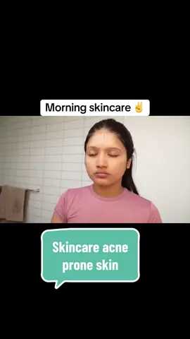 “My morning skincare routine to keep my acne-prone skin calm and balanced 🌞 Non-sponsored, just sharing what works for me! #acneskin #acneskincare #acneskincareroutine #acneproneskin #acnescars #darkspots #skincare #skincareroutine #acnepositive 