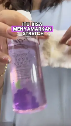 Insecure strechmarks di perut