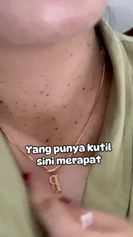 Ampuh banget sihh si biru mungil ini 😍 #penghilangkutil #salepkutil #penghilangkutil #obatkutil 