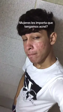 La verdad es algo q causa inseguridad #acnetreatment #acne #acneskin #isotretinoina #cuticlin #parati #inseguridad #inseguros #deprecion #contenido 