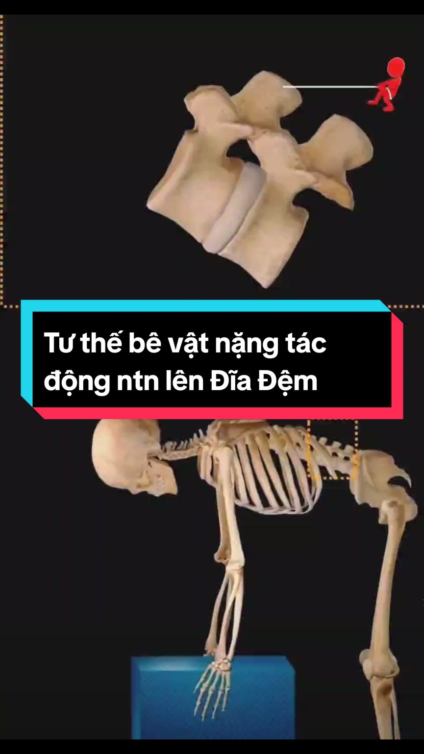 3d Mô phỏng áp lực lên đĩa đệm ở tư thế cúi xuống bê, nhấc đồ vật nặng.. Từ video các bạn thấy rõ và chú ý tư thế lưng khi cúi bê vật nặng , để bảo vệ tốt cho csong đĩa đêm của mình .  #BsDyChiCuong  #thoatvidiadem  #châmcứu  #chiropractic  #viral #xuhuong 