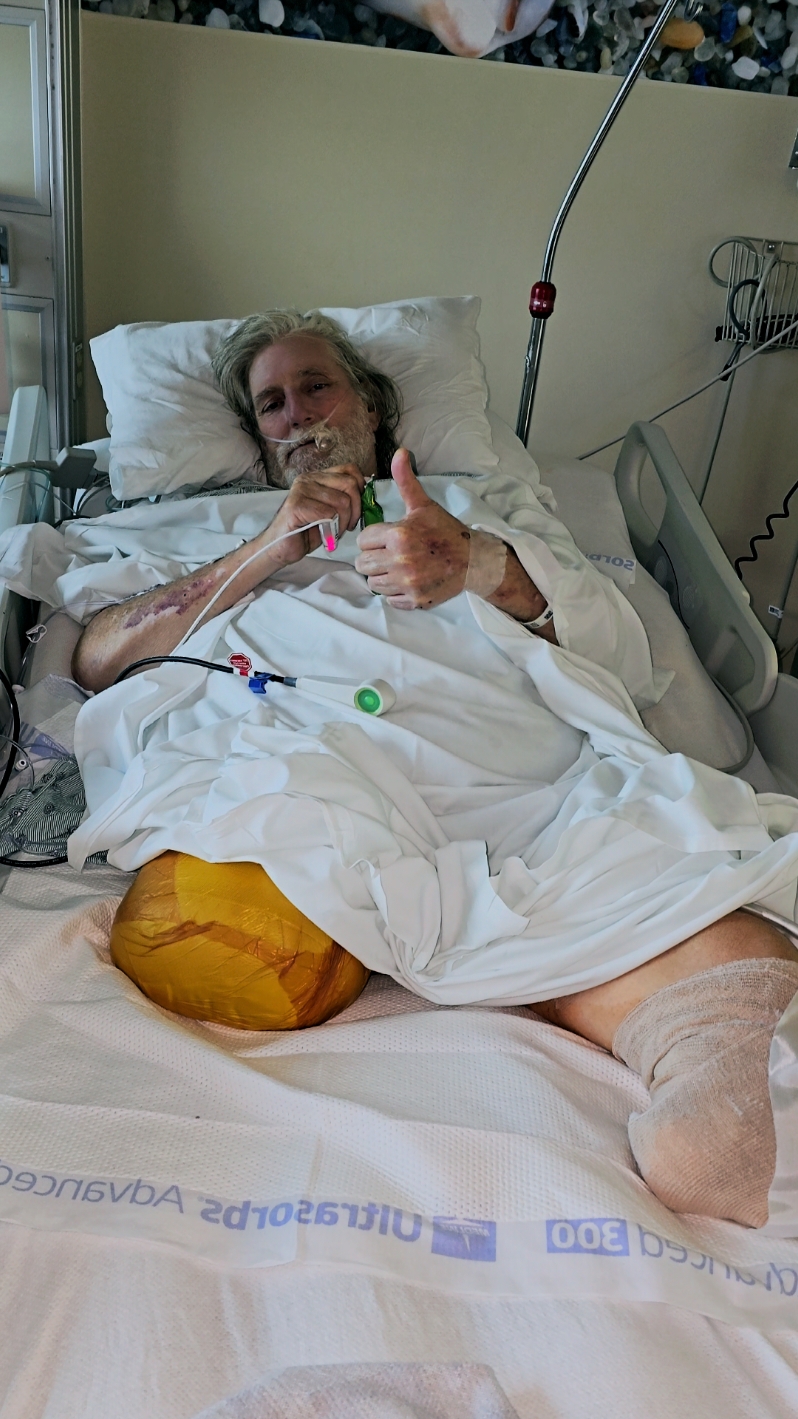 This serves as a cautionary tale regarding the severe consequences of neglecting one's health, particularly for individuals with diabetes. On Sunday, October 27th, 2024, my father underwent a life-saving procedure involving the amputation of both his legs. It is his sincere hope that others can learn from his unfortunate experience. If you have any wounds that are not healing, especially if you are diabetic, please seek immediate medical attention. The potential consequences are simply not worth the risk. Prayers for his healing and well-being during this difficult time are greatly appreciated. 🙏🙏🙏 #diabetes #amputee #infection #diabetic #lifechanging 