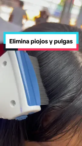 Elimina piojos y pulgas con la nueva aspiradora😊✨✨ #elim #piojos #piojosyliendres #eliminatorias #piojostiktok #liendra #viral_video #piojos #guayaquil_ecuador🇪🇨 #guayaqui #importadora #tiktokviral #tiktok_india #aspiradora #aspira #enviosnacionales #parati #aspiradora #aspirante 