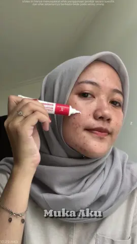 Lengkapi produk kecantikanmu dengan cream chalonese ini🥰❤ #creamchalonese #kecantikanalami #bpomskincare #flawlessglow