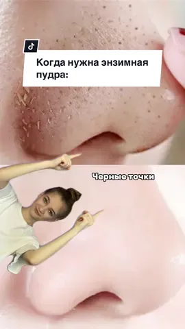 Арт на энзимную пудру 💗 Wb 142044104 #черныеточки #проблемы #красота #здоровье 
