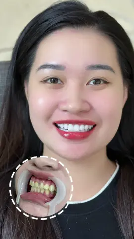 Nụ cười đẹp chuẩn Dr Han 🦷