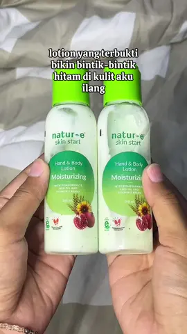 NO ENDORSE! beneran seampuh itu natur e @Natur-E Indonesia #naturelotion #naturelotionhijau #bintikhitamtangan 