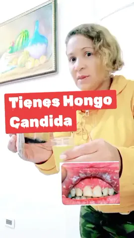 Hongo cadida#doctora_amor09 #LIVEhighlights #tiktokviraltrending #candidiasis 