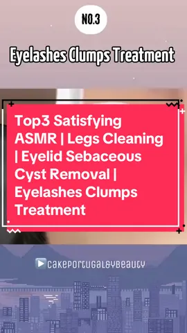 Top3 Satisfying ASMR | Legs Cleaning | Eyelid Sebum Extrusion | Big Pimple | Eyelashes Clumps Treatment | ASMR 뭉친 속눈썹을 제거 애니메이션 | 거대한 눈 꺼풀 다래끼 치료 #asmr #cleaning #calmcareclinic #asmrcleaning #eyecleaning #asmrclinic #eyecare #bigpimple #satisfyingcleaning #eyelid #cystremoval #eyelashes 