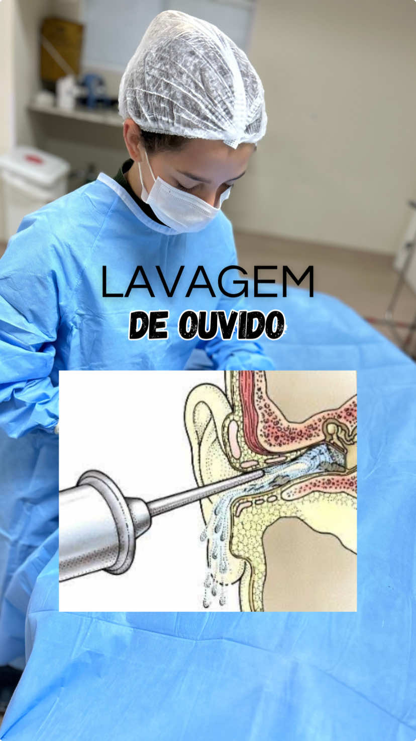 lavagem de ouvido 💦👂#medicina #medica #plantao #saude #otorrinolaringologia 