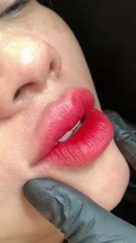 #phun môi collagen hay pha lê 