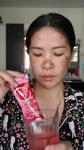 เป็นฝ้า หน้่าหมองคล้ำ‼️ กลูต้าคอลลาเจน ส้มสีเลือดเอาอยู่ 🍊🩸 ผิวพัง แต่ยังกลับมาปังได้ #กลูต้าส้มเลือด สูตรดริปผิว ลดฝ้ากระ 🩸🍊 ท้าให้ลอง ผลลัพธ์ตั้งแต่เซ็ตแรก #กลูต้าส้มเลือด #SWPTHAILAND 