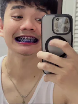 เปลี่ยนสียางฟันด้วยตัวเอง🤣 #สียางจัดฟัน #ยาม่วงเปลี่ยนสียาง #fypシ゚viral #ยิ้มหวาน 