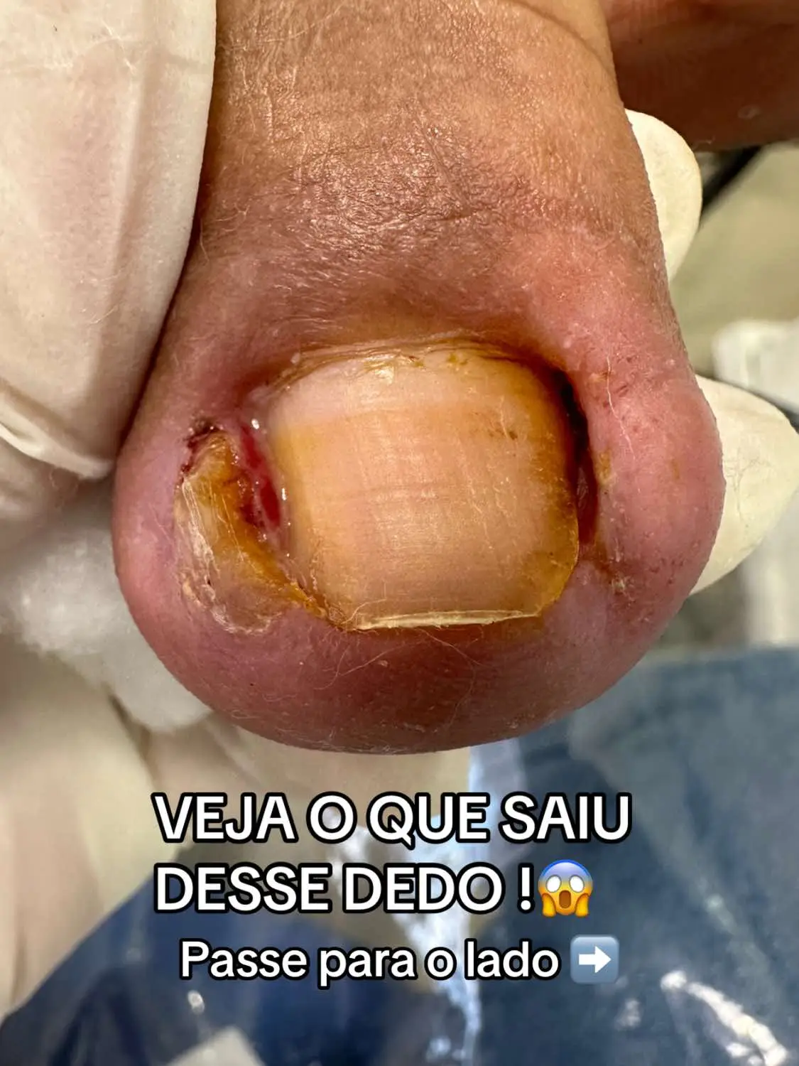 #satisfatorio #unhaencravada #brasil #unha 