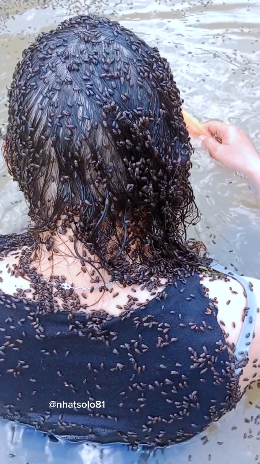 too many lice 😭😭😭😭#lice#tick#ticktock #london 