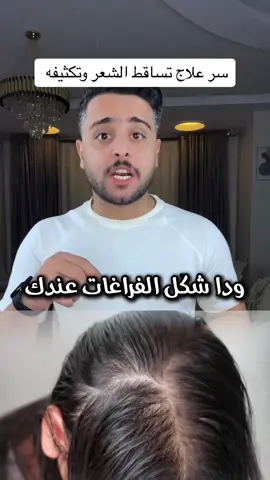 سر علاج تساقط الشعر وتكثيفه في اسرع وقت  . . . . . لازم ناخد فيتامينات تشتغل علي الشعر وكمان نستخدم هيرروتس لوشن مره كل يوم @hairoots.eg  #علاج_تساقط_الشعر #تكثيف_الشعر #سر_الشعر_الكثيف #روتين_العناية_بالشعر #صحة_الشعر #نصائح_تيك_توك #الصيدليه 