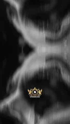 #علي_فاروق#معلش#جديده #vip2020cabo #تصميم_فيديوهات🎶🎤🎬تصميمي #المتحدث_الرسمي_باسم_العظمه_cabo 