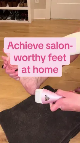 Tired of constantly having rough, dry feet? Me too! This electric foot file works sooo well! Within seconds my feet were smoother. #electricfootfile #footfile #callusremoval #callusremover  #callus #smoothfeet #tiktokshop 