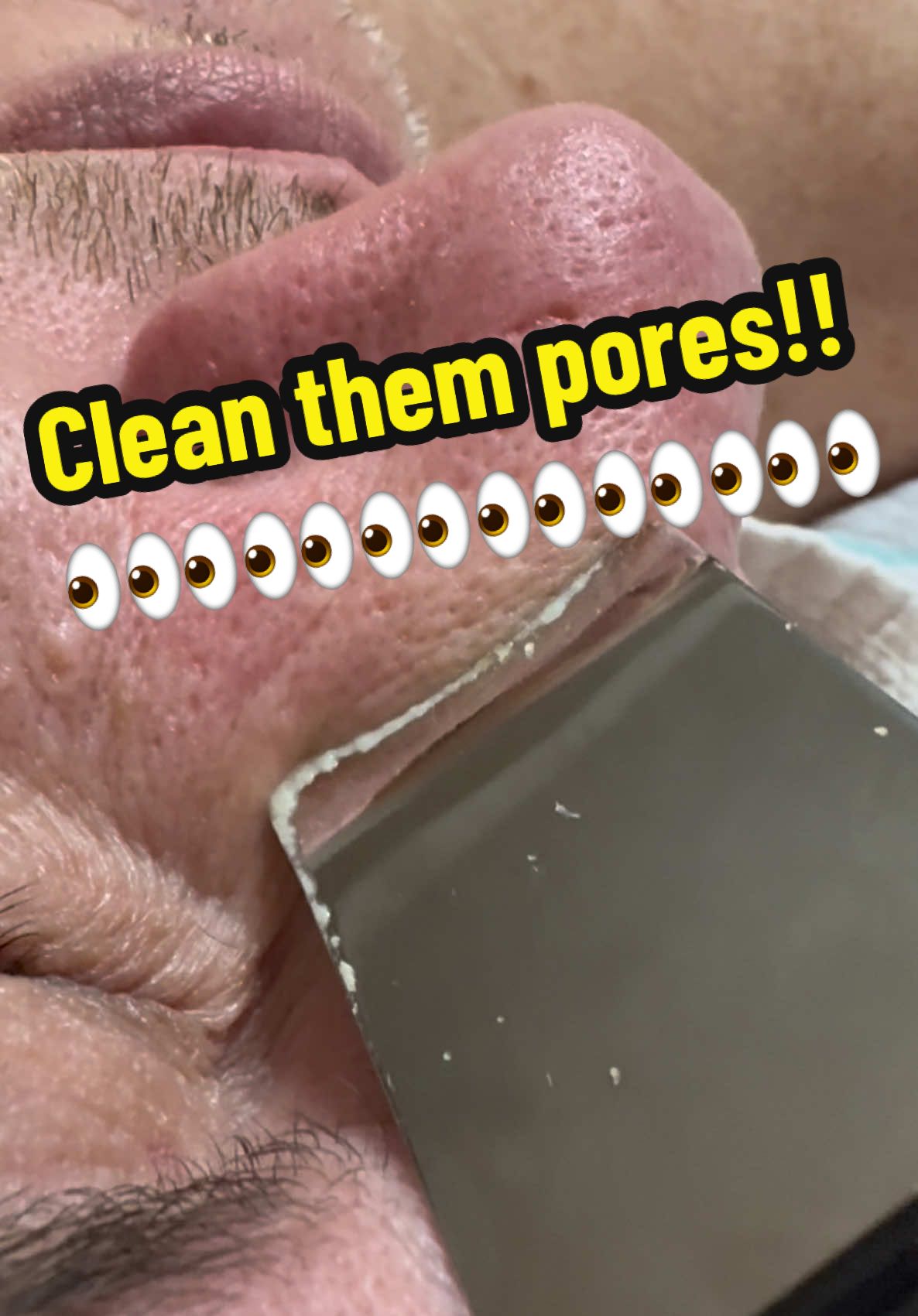 Wooooowwwww!! It really works 👏🏼 #skincare #facial #satisfyingvideo #ew #TikTokShop #fyp #wow #skintok #skin 