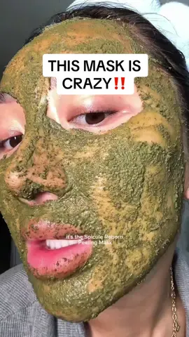 Spicules are microscopic needle particles that helps stimilate collagen and exfoliates your skin! This Spicule Peeling Mask from @PESTLO_OFFICIAL feels like a micro-needling treatment in mask form! @YesStyle #microneedling #facemask #koreanskincare 