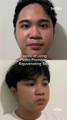 This is a must have for all men out there. Protect your skin with Pedro Premium Rejuvenating Set. Check yellow basket for a glow up! @Shantahl #ShantahlCosmetics #PedroPremiumRejuvenatingSet #DiscoVeiries #dvms 