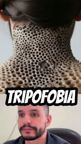 A repulsa ou aversão a buracos ou lesões agrupadas de forma irregular tem um nome: tripofobia. Esse padrão de buraquinhos pode estar na pele, em tecidos, objetos ou animais. Aracnofobia é a fobia de aranhas. A pessoa que apresenta fobia de aranha mantêm distância de locais onde possam existí-las, evitam viajar para o campo ou morar em um lugar onde apareça uma aranha, mesmo sendo pequena.