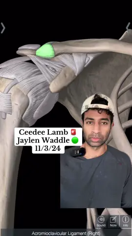 Ceedee lamb, Jaylen Waddle injury update #cowboys #dolphins