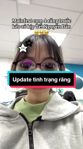 Hy vọng răng khít kịp để Tết chụp hình xuynhhh huhu #braces #niengrangmaccai #nhatkyniengrang🦷 #niềng_răng #tet2025♥️🎆 