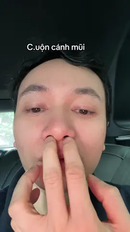 #nangmui #xuhuong #bsphamhao #suamuihong #gheptrungbi #lamdep 