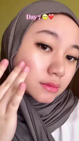 Before this sarah stress gilaa tengok muka sndiri 😩 dgn jerawat nyaa and bintik hitam yg susah sgt nak hilang. smpai kwn sarah suggest this serum and tgk lah result diaa 🥹❤️ sumpah besttt !!  #fypage #foryou #g2g #skincareroutine 