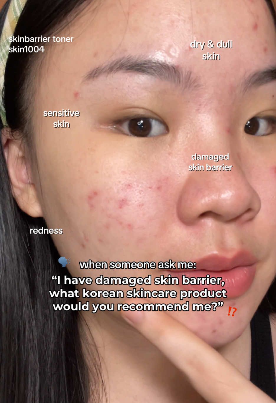 korean skincare product to help with damaged skin barrier? try this!!! 🫶🏻✨ this @SKIN1004 Official probio-cica essence toner is the answer. #skinbarrier #skinbarrierrepair #toner #probiocica #skin1004 #koreanskincare #kbeautyskincare #kbeauty #skin1004centella 