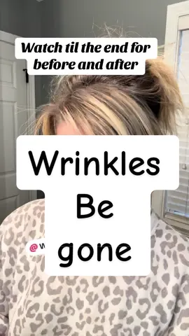 My wrinkles are diminishing week after week. Must have been dehydrated skin. #hyaluronicacid #wnp #wrinkles #over40mom #tiktokshopblackfriday #tiktokshopcybermonday 
