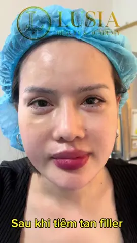 #cangchinangco #lamdep #cangchi 