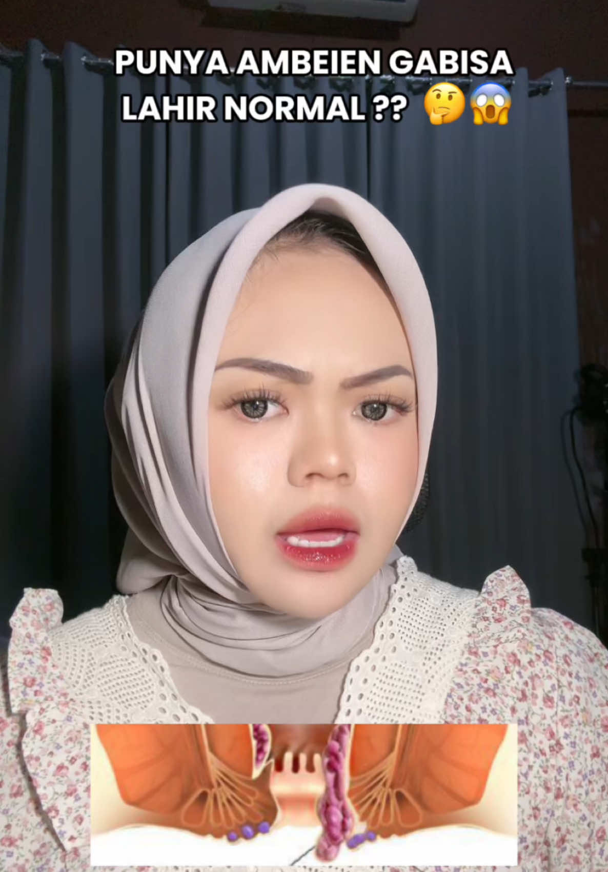 Emang boleh punya Ambeien lahiran normall ??? Tonton sampe akhir yaaa, biar gak salah paham  🫶🏼 #bidansangrilah 