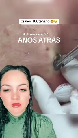 Cravos 100centenario  #anosatrás #cravos #limpezasatisfatoria #terapia #reagindo #satisfatório 