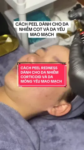 Da mỏng yêu nhiễm cot thì có điều trị được không ? Và điều trị ntn . #spa #lamdep #viral #fpy #daotaohocvien #daotaohocvienchuyennghiep #bacninh #peelda #duocmypham 