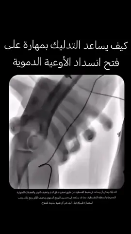#معلومة_منير #معلومة 